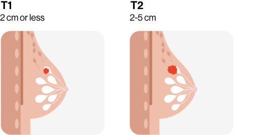 cancer sizes one
