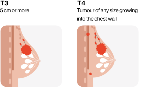 cancer sizes two